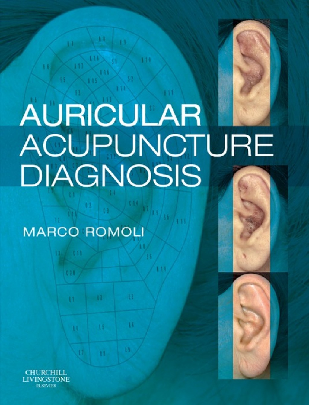 Auricular Acupuncture Diagnosis  â€“ PDF/EPUB Version Downloadable