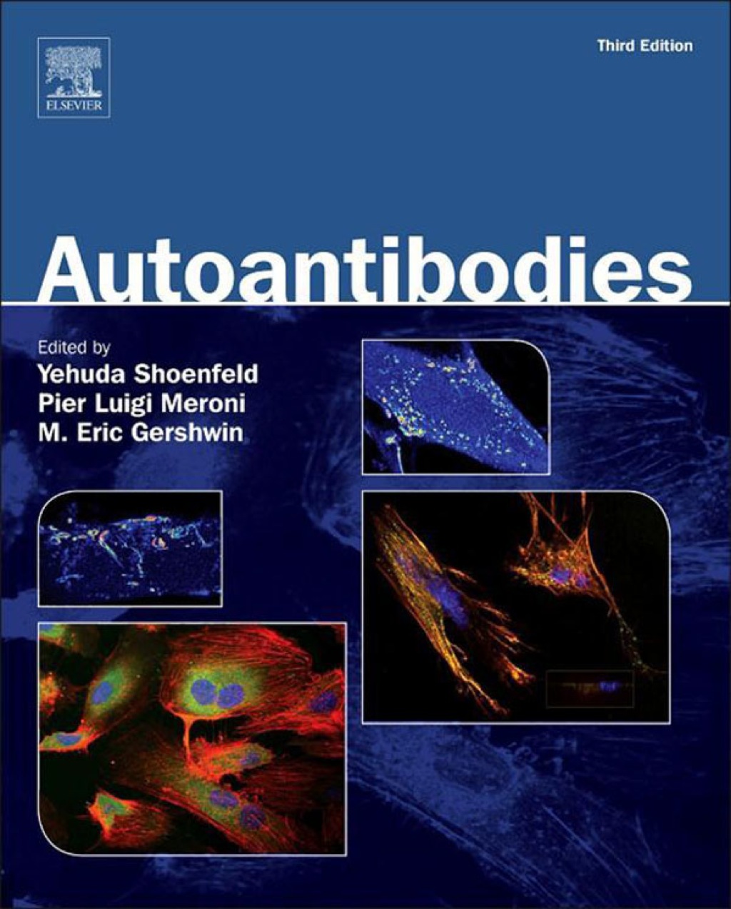 Autoantibodies 3rd Edition – PDF/EPUB Version Downloadable Autoantibodies 3rd Edition – PDF/EPUB Version Downloadable - Image 1