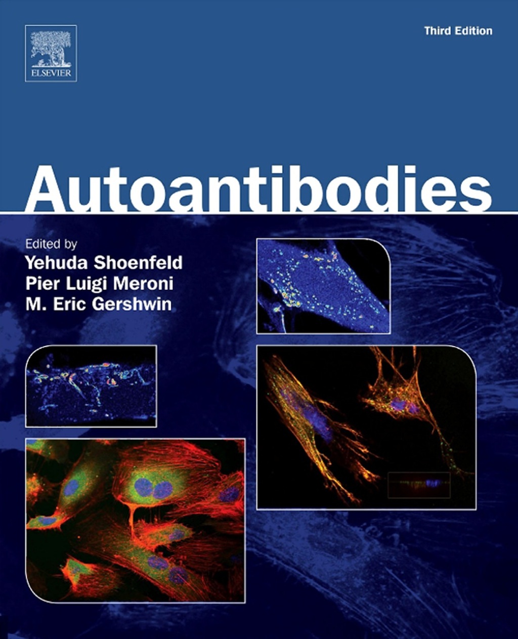 Autoantibodies 3rd Edition â€“ PDF/EPUB Version Downloadable