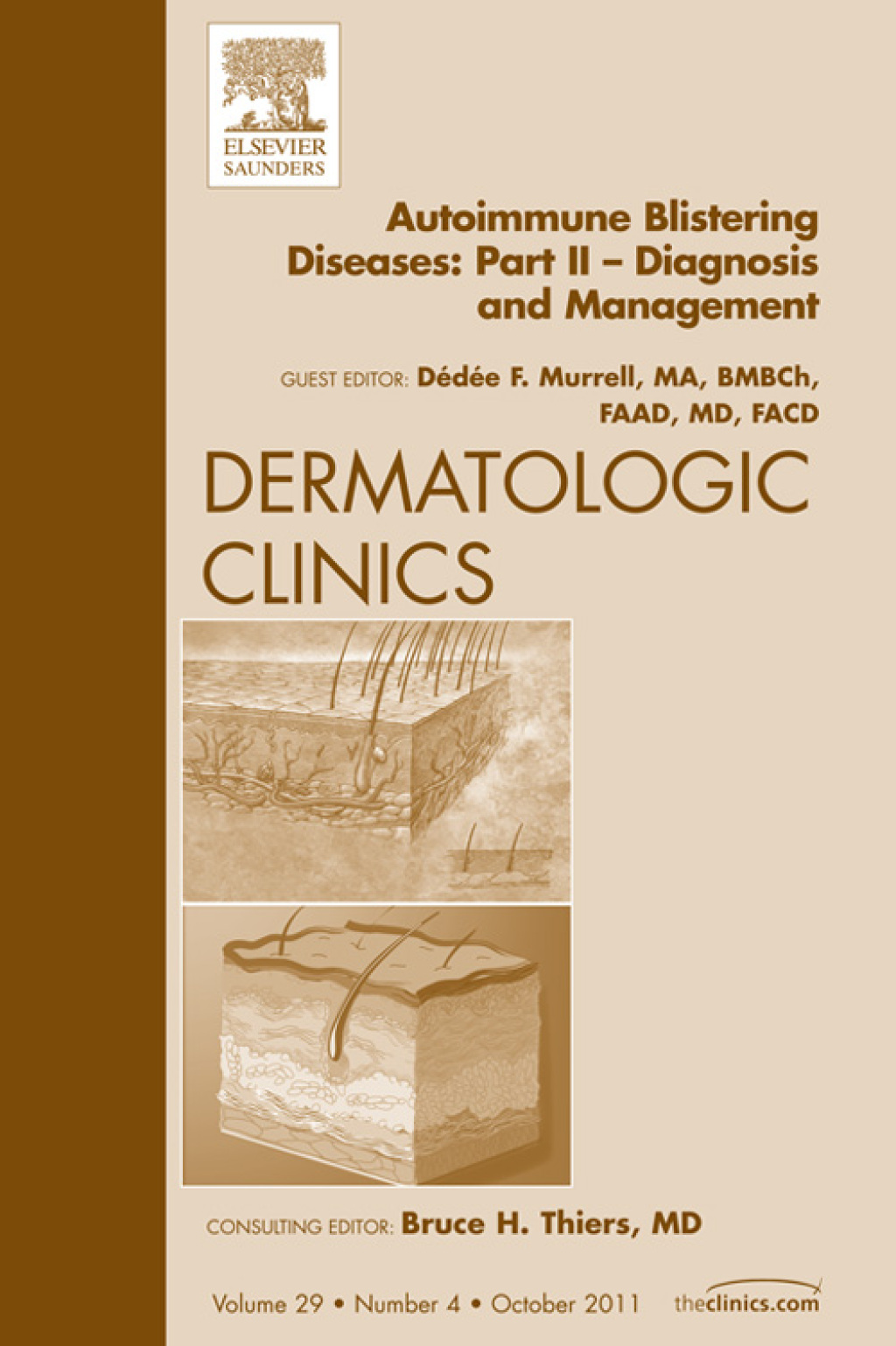 Autoimmune Blistering Diseases, Part II, An Issue of Dermatologic ...