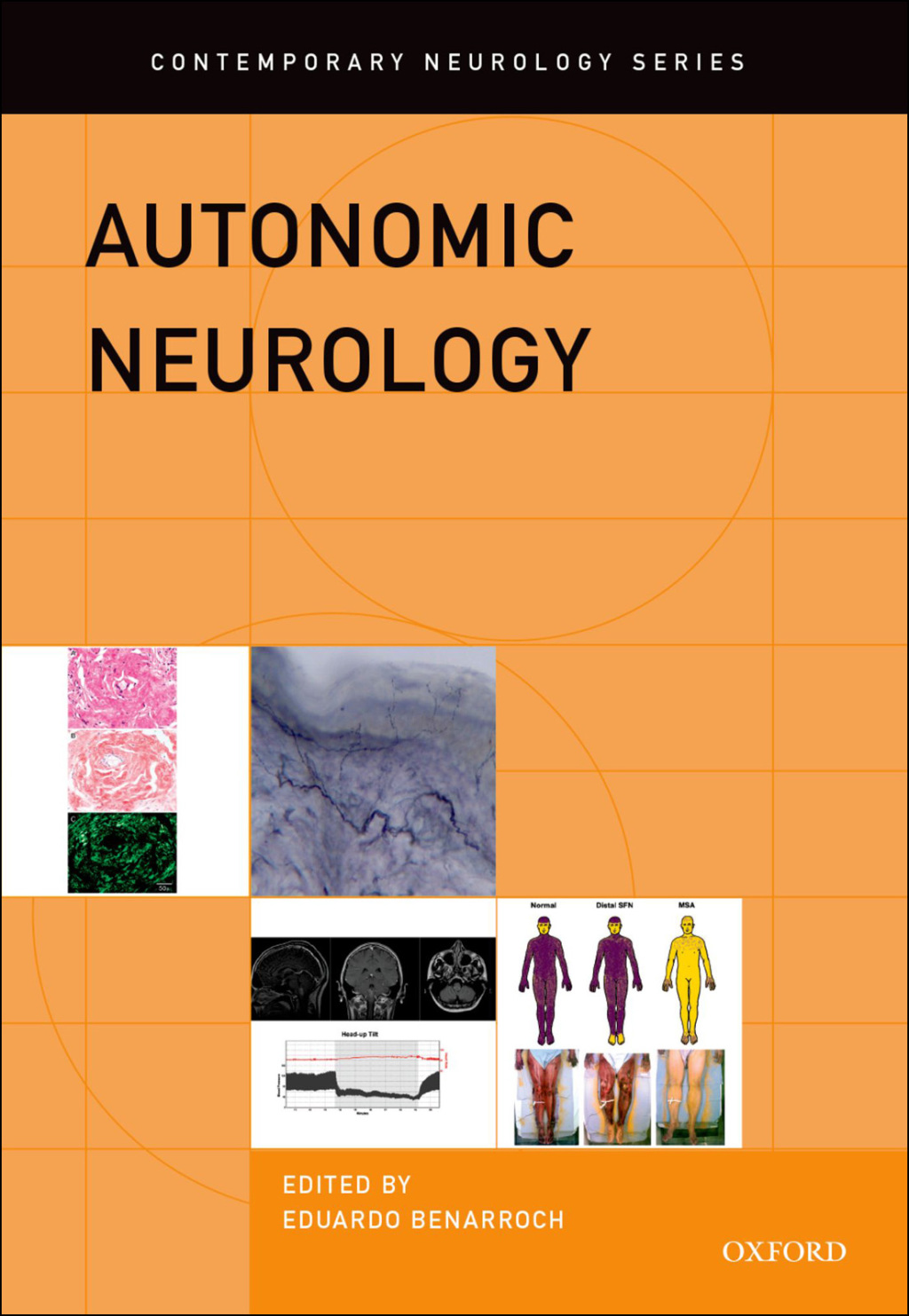 Autonomic Neurology 1st Edition â€“ PDF/EPUB Version Downloadable