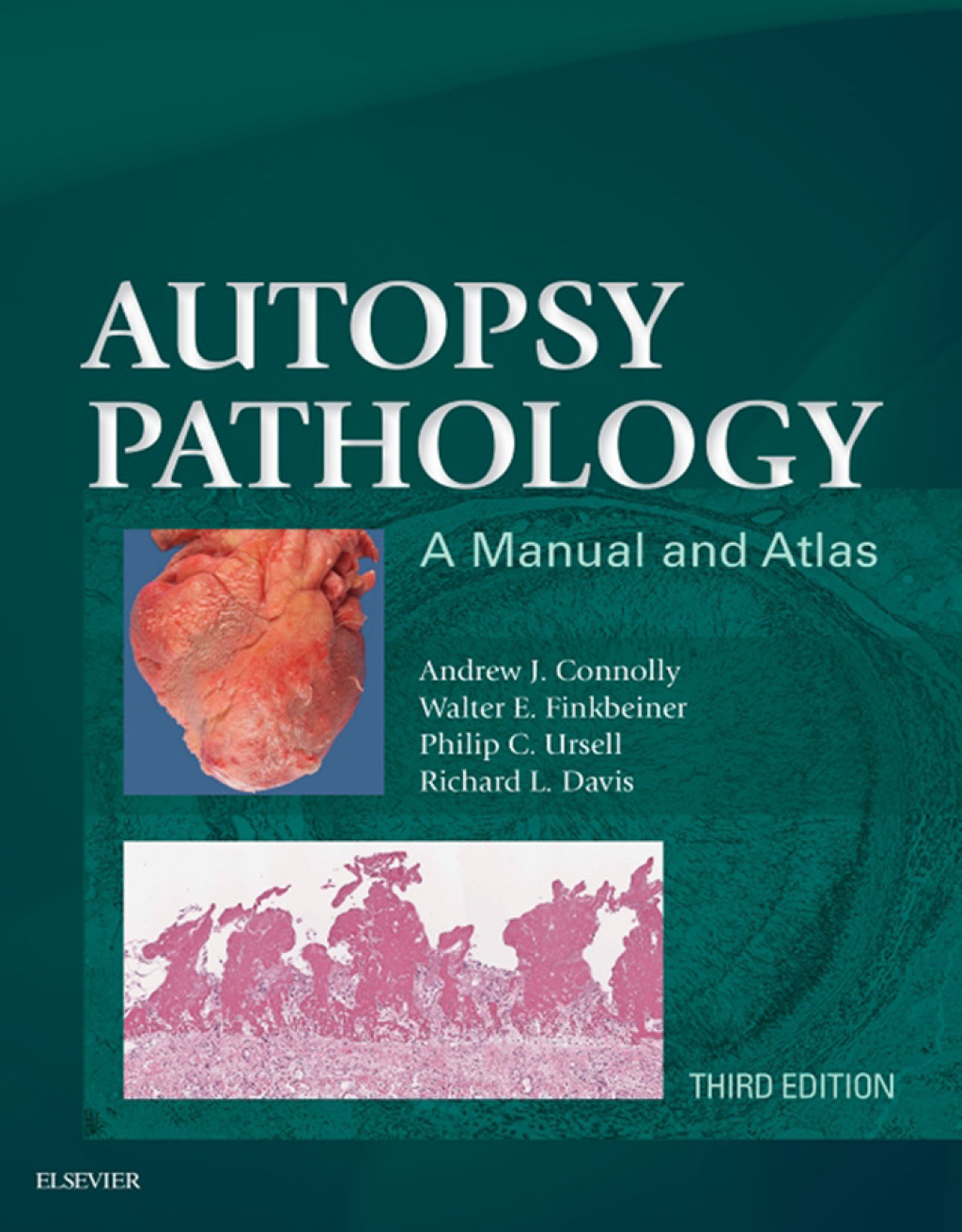 Autopsy Pathology: A Manual and Atlas 3rd Edition â€“ PDF/EPUB Version Downloadable