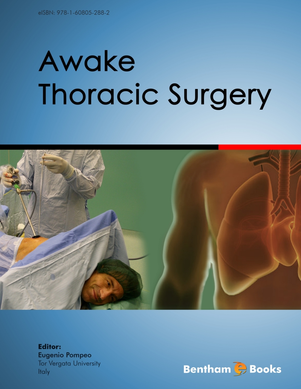 Awake Thoracic Surgery 1st Edition â€“ PDF/EPUB Version Downloadable