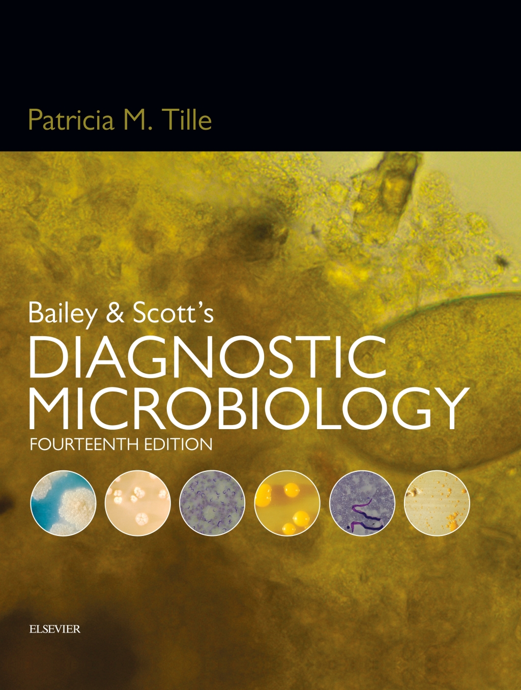 Bailey & Scott's Diagnostic Microbiology 14th Edition â€“ PDF/EPUB Version Downloadable