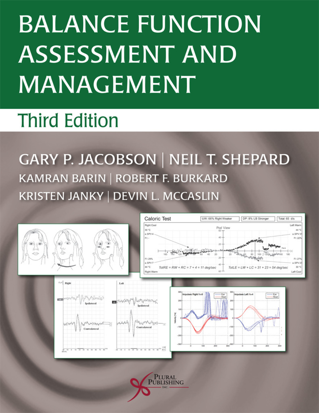 Balance Function Assessment and Management 3rd Edition â€“ PDF/EPUB Version Downloadable