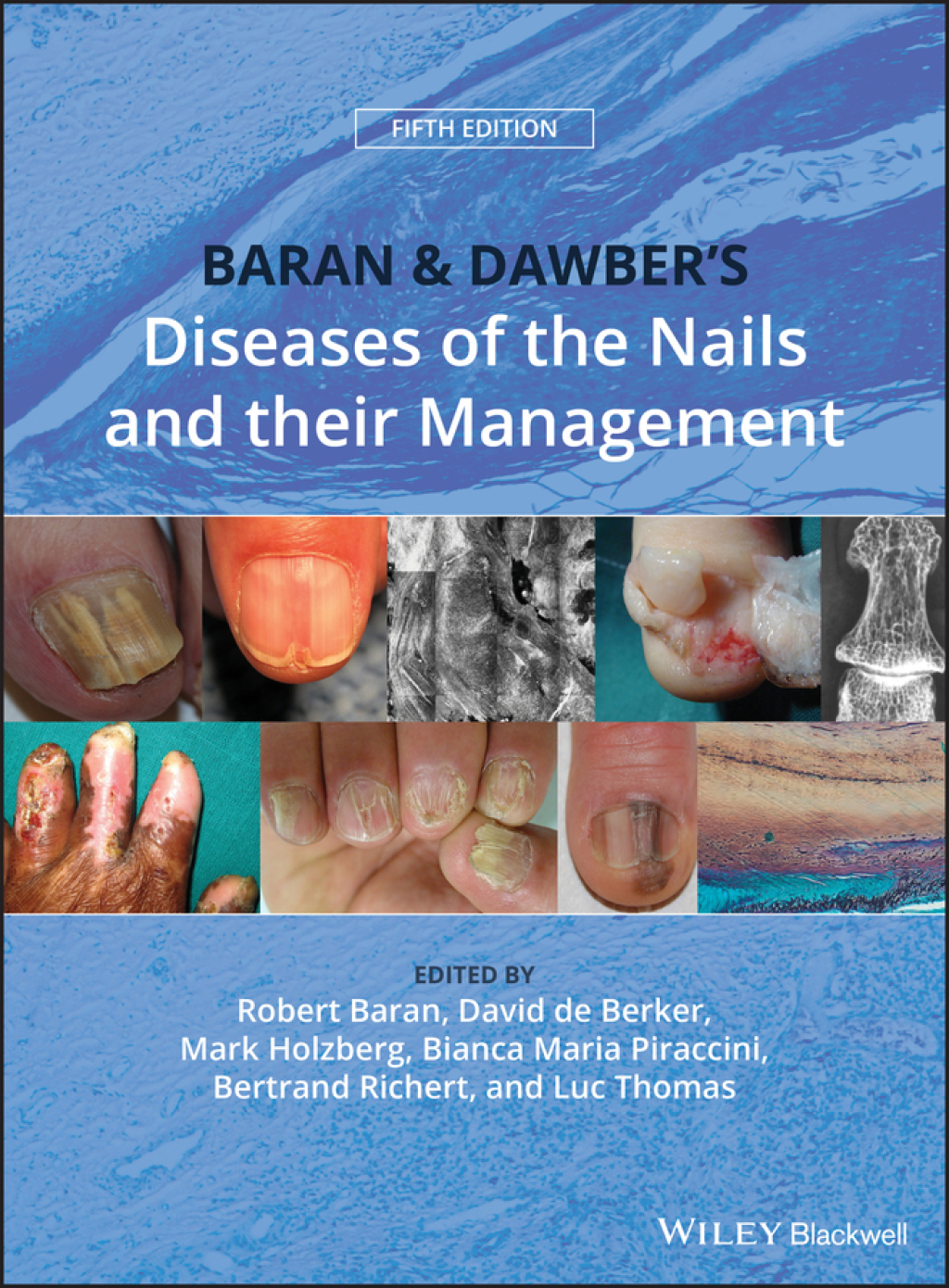 Baran and Dawber's Diseases of the Nails and their Management 5th Edition â€“ PDF/EPUB Version Downloadable