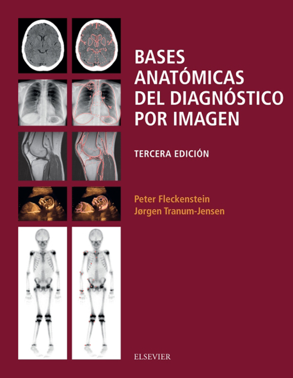 Bases anatÃ³micas del diagnÃ³stico por imagen 3rd Edition â€“ PDF/EPUB Version Downloadable