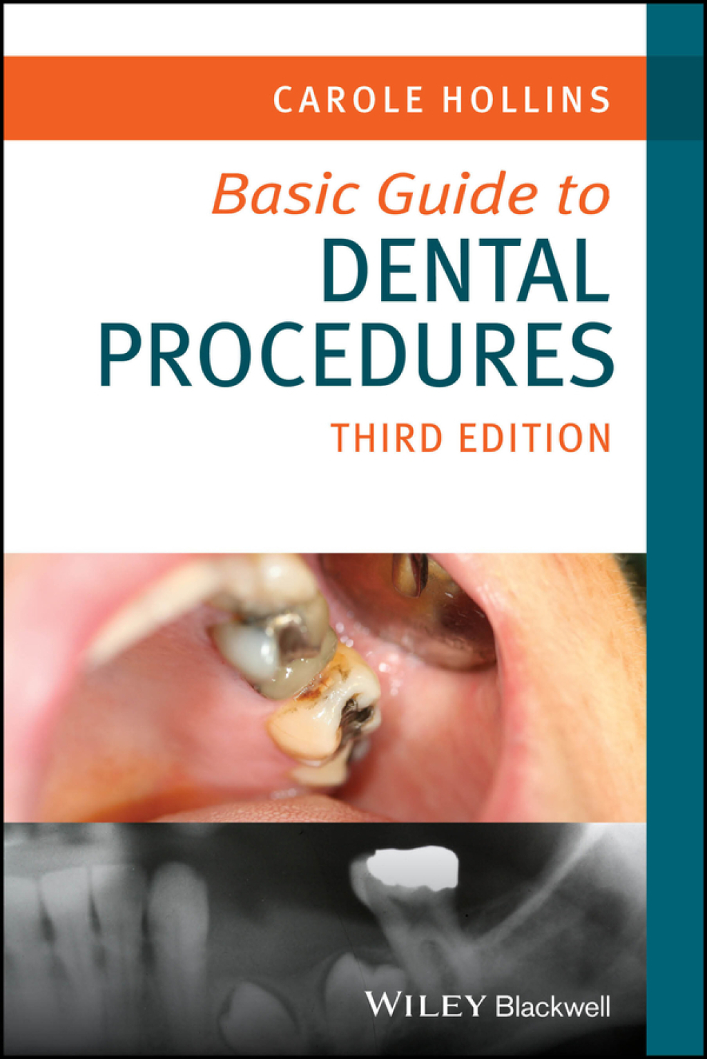 Basic Guide to Dental Procedures 3rd Edition - (PDF/EPUB Version)