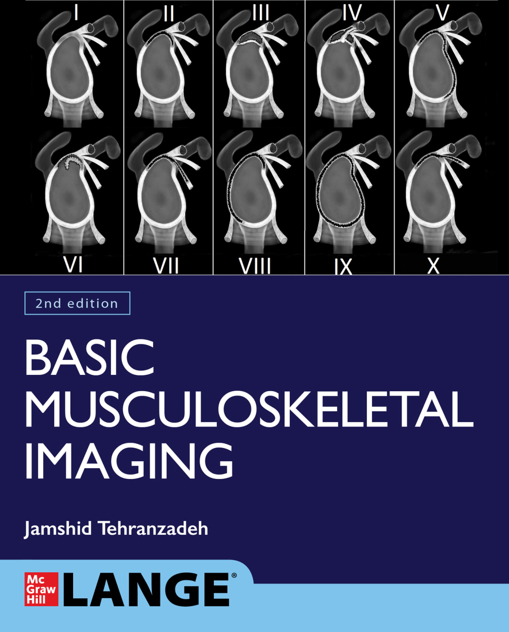 Basic Musculoskeletal Imaging, Second Edition 2nd Edition â€“ PDF/EPUB ...
