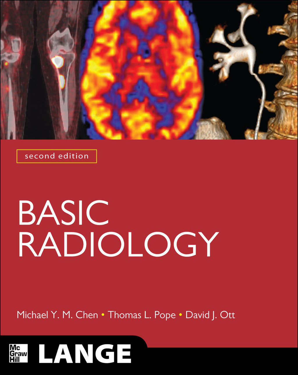 Basic Radiology, Second Edition 2nd Edition â€“ PDF/EPUB Version Downloadable