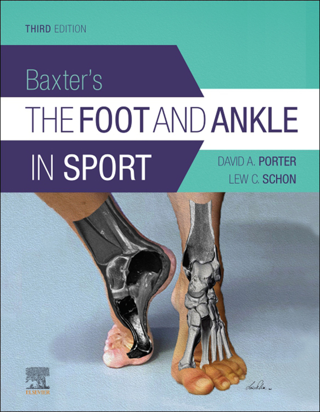 Baxter's The Foot and Ankle in Sport 3rd Edition â€“ PDF/EPUB Version Downloadable