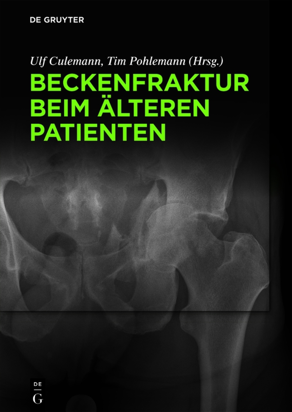 Beckenfraktur beim Ã¤lteren Patienten 1st Edition â€“ PDF/EPUB Version Downloadable