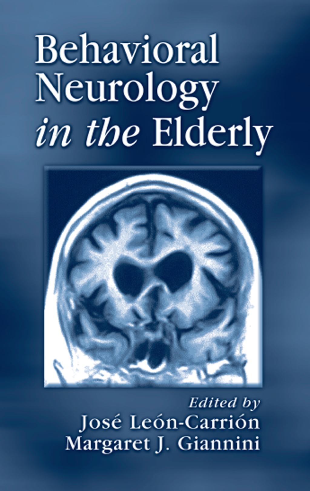Behavioral Neurology in the Elderly 1st Edition â€“ PDF/EPUB Version Downloadable