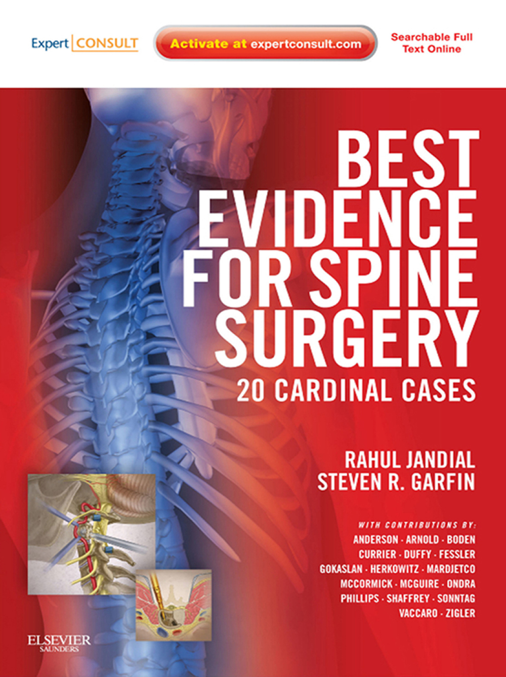 Best Evidence for Spine Surgery 20 Cardinal Cases â€“ PDF/EPUB Version Downloadable