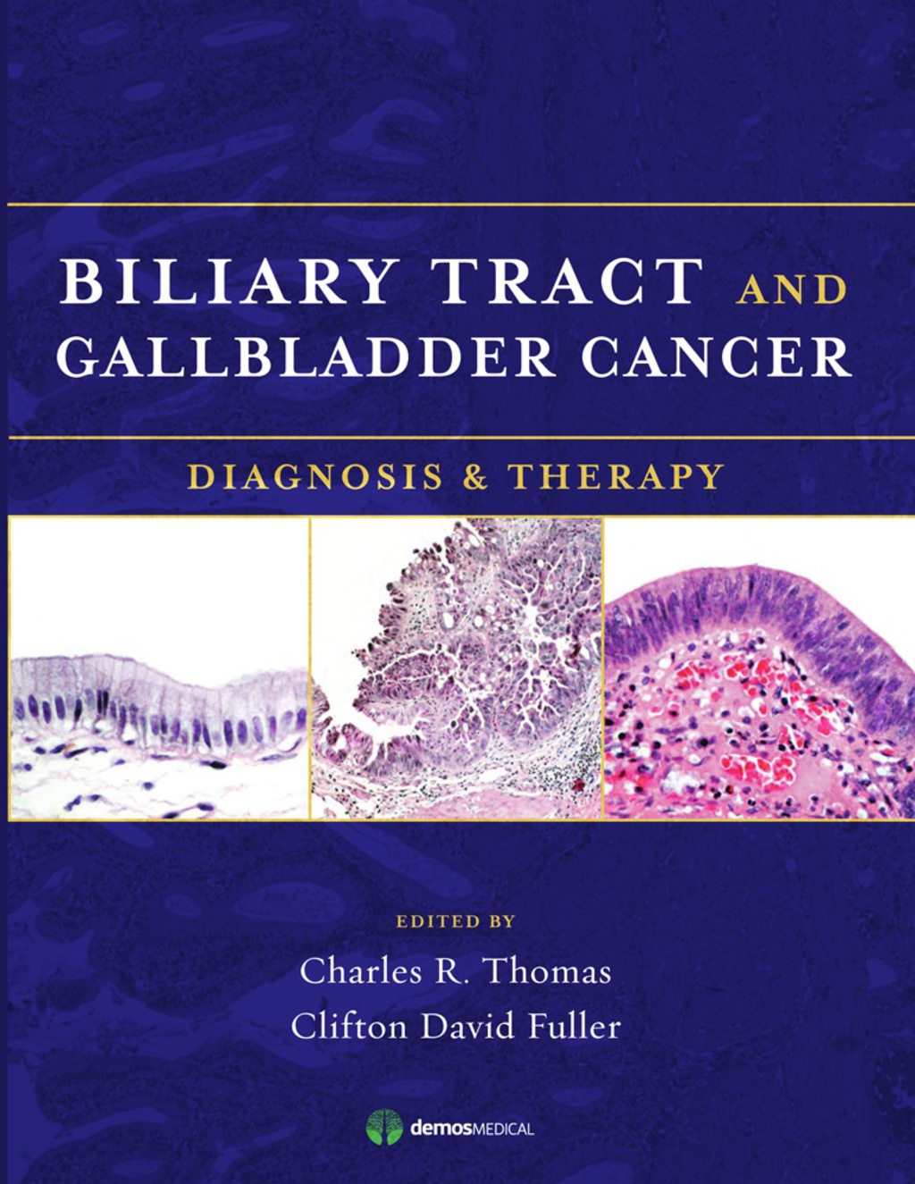 Biliary Tract and Gallbladder Cancer Diagnosis and Therapy 1st Edition â€“ PDF/EPUB Version Downloadable