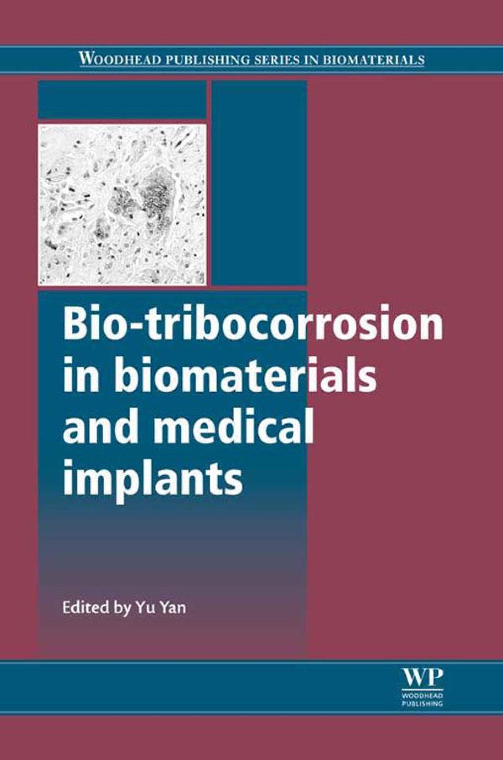 Bio-Tribocorrosion in Biomaterials and Medical Implants – PDF/EPUB Version Downloadable Bio-Tribocorrosion in Biomaterials and Medical Implants – PDF/EPUB Version Downloadable - Image 1