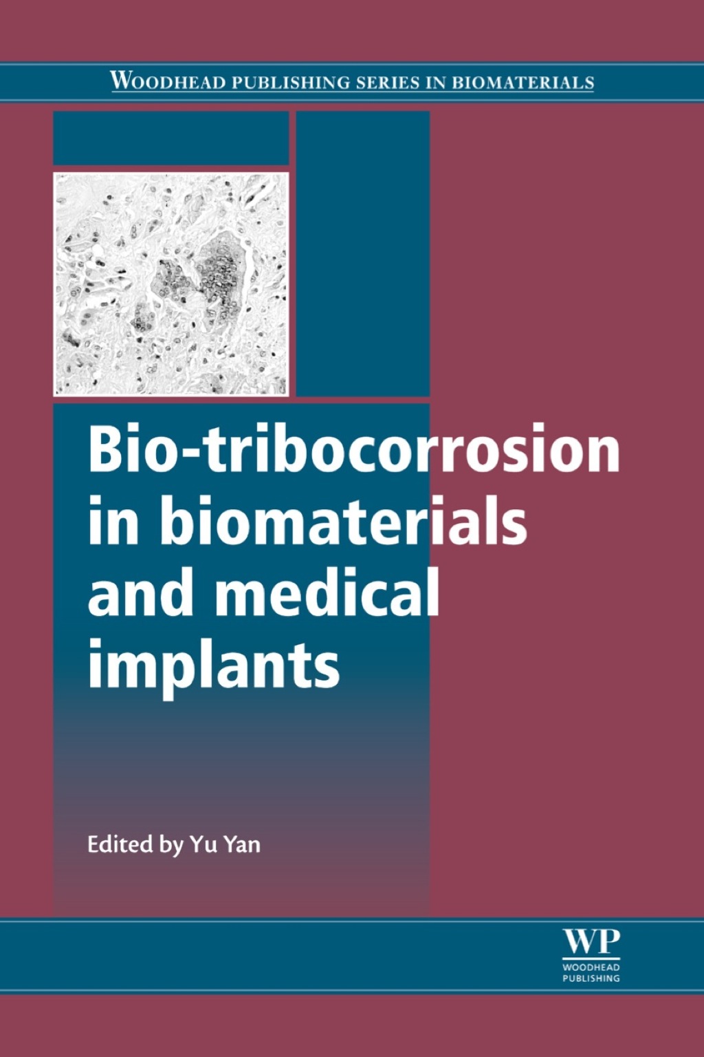 Bio-Tribocorrosion in Biomaterials and Medical Implants â€“ PDF/EPUB Version Downloadable