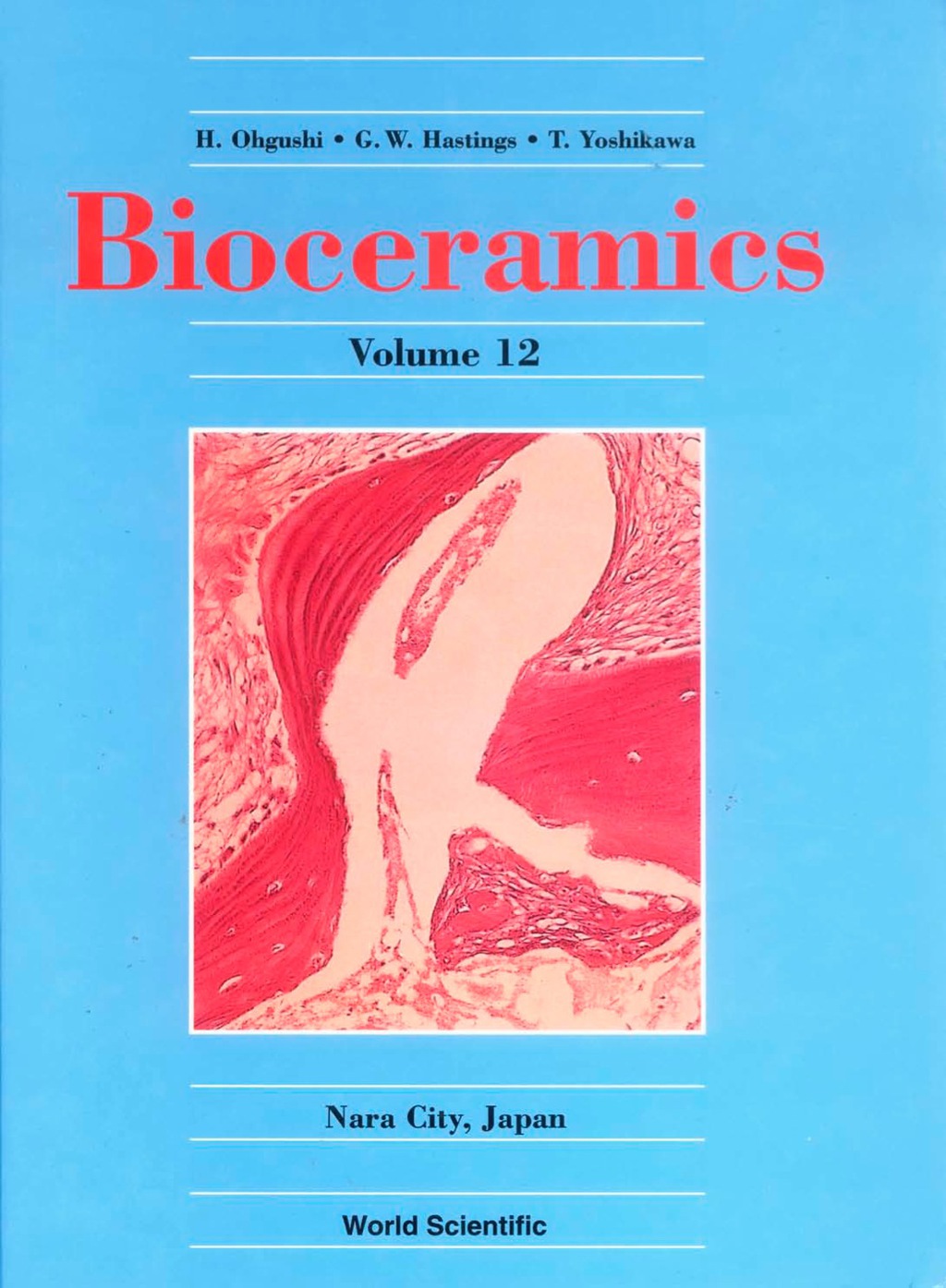 Bioceramics: Volume 12 - Proceedings Of The 12th International Conference On Ceramics In Medicine 1st Edition â€“ PDF/EPUB Version Downloadable