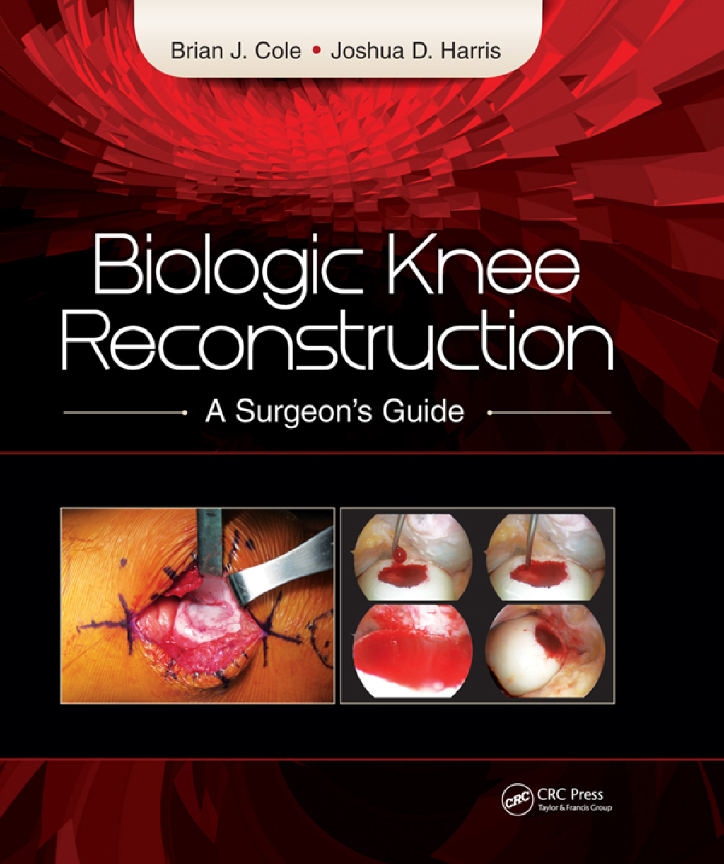 Biologic Knee Reconstruction A Surgeon's Guide 1st Edition â€“ PDF/EPUB Version Downloadable