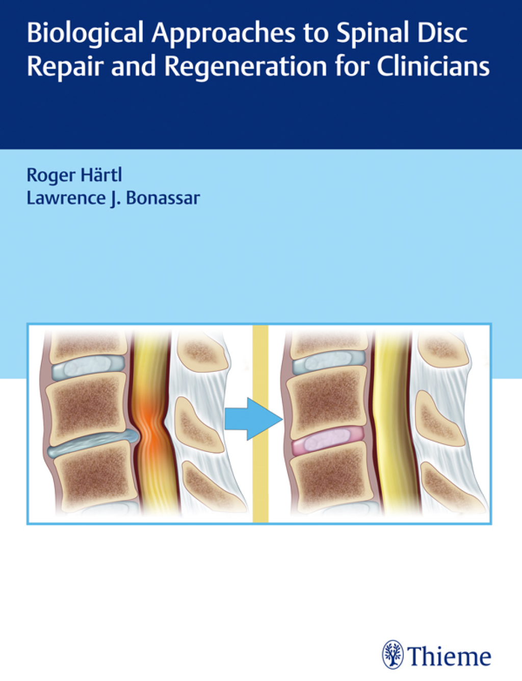 Biological Approaches to Spinal Disc Repair and Regeneration for Clinicians 1st Edition â€“ PDF/EPUB Version Downloadable