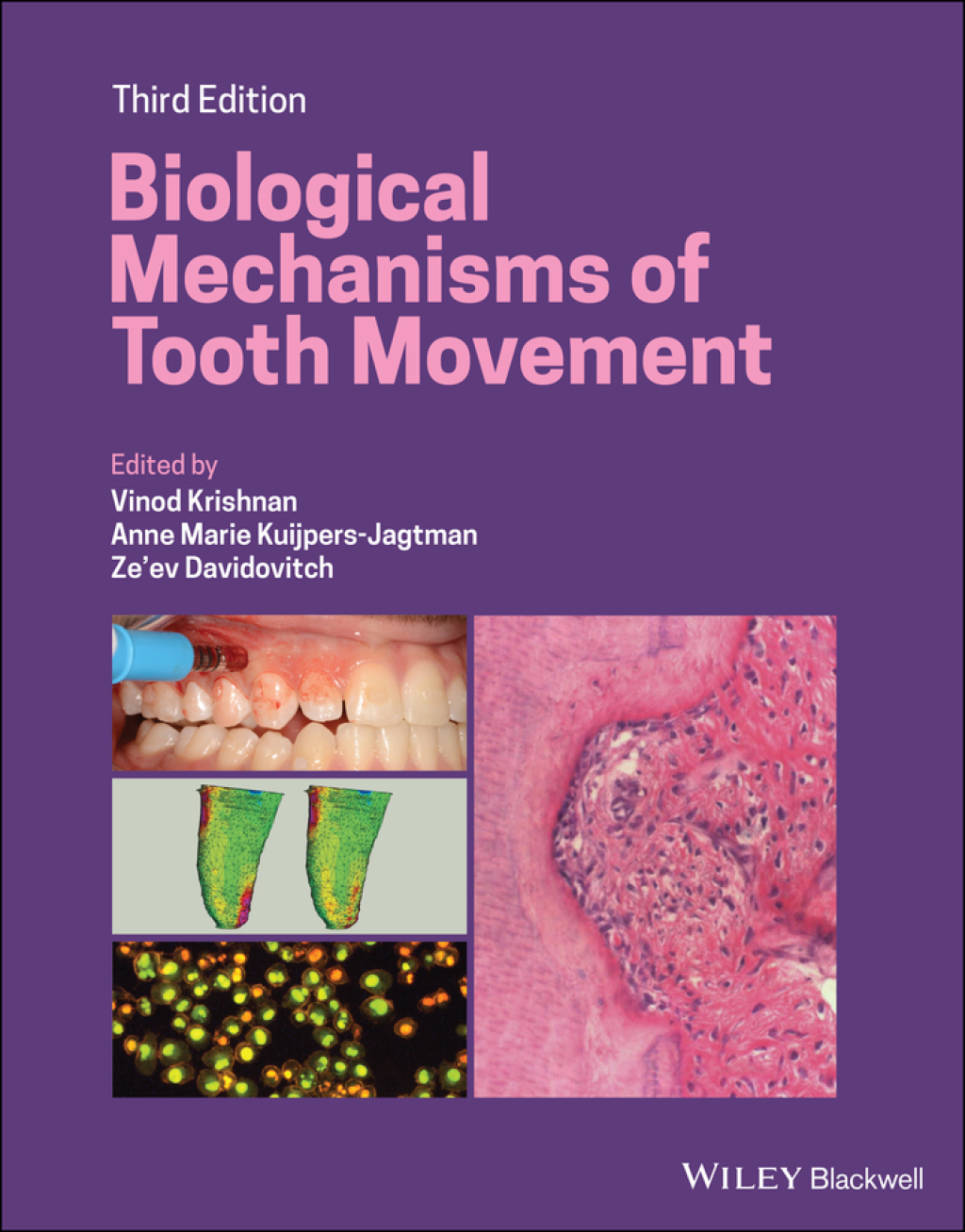 Biological Mechanisms of Tooth Movement, 3rd Edition 3rd Edition â€“ PDF/EPUB Version Downloadable