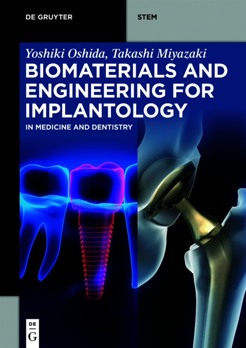 Biomaterials and Engineering for Implantology In Medicine and Dentistry 1st Edition â€“ PDF/EPUB Version Downloadable