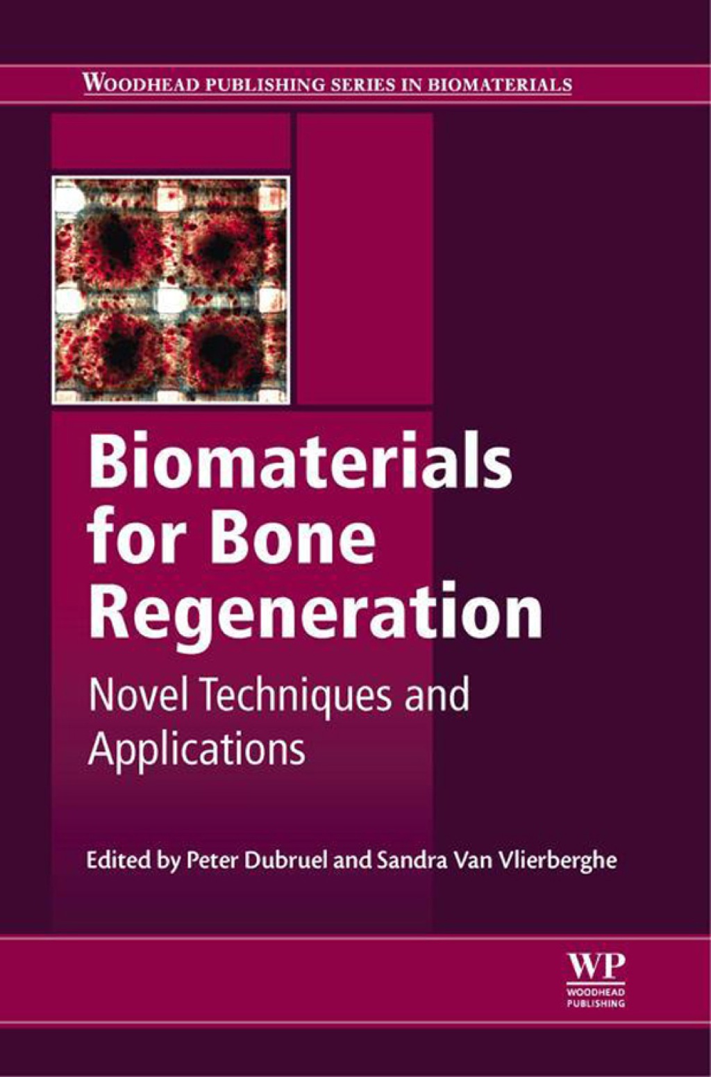 Biomaterials for Bone Regeneration: Novel Techniques and Applications â€“ PDF/EPUB Version Downloadable