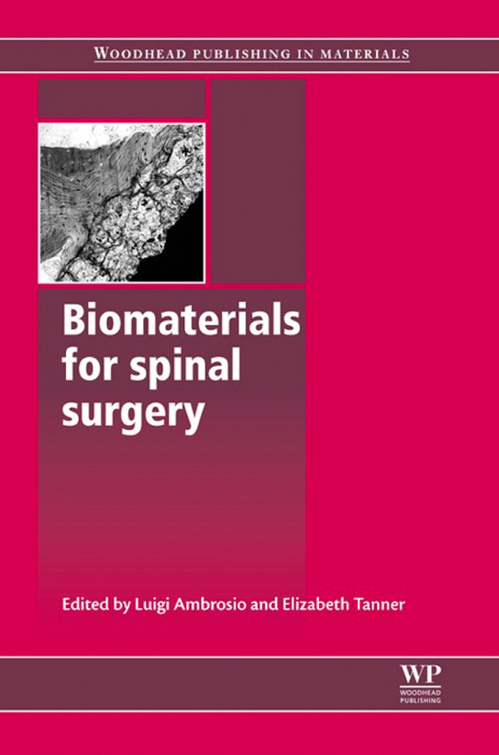 Biomaterials for Spinal Surgery â€“ PDF/EPUB Version Downloadable