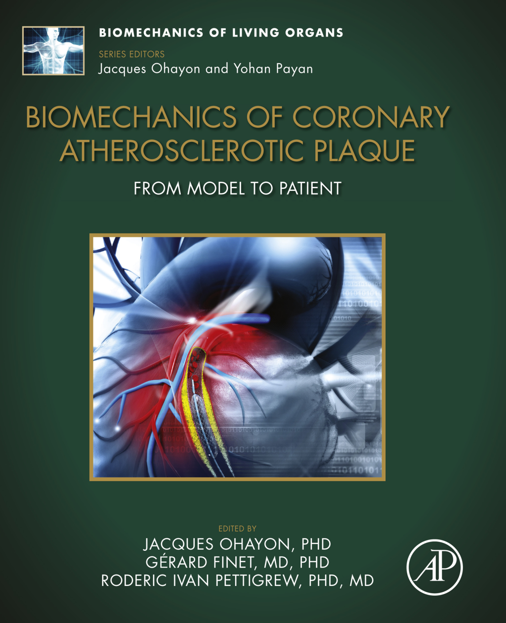 Biomechanics of Coronary Atherosclerotic Plaque From Model to Patient ...