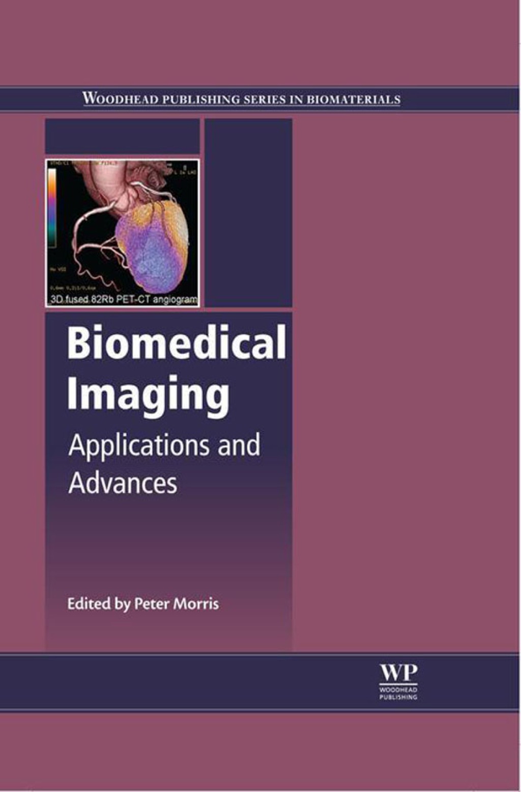 Biomedical Imaging: Applications and Advances â€“ PDF/EPUB Version Downloadable