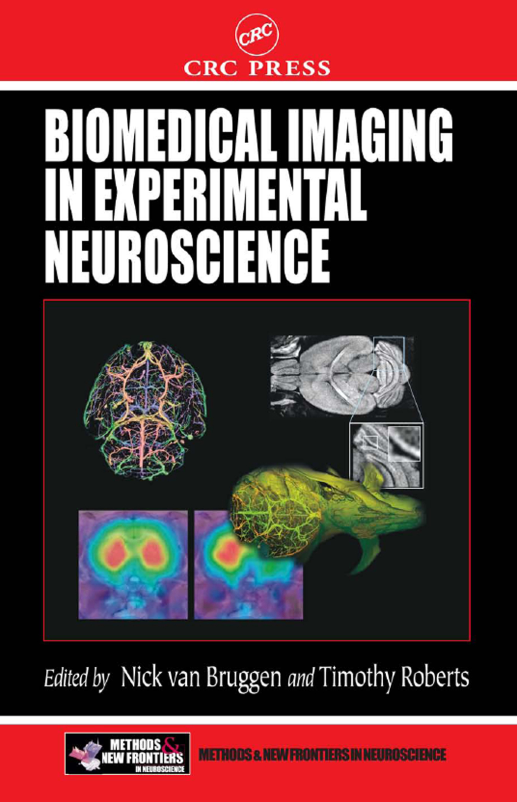 Biomedical Imaging in Experimental Neuroscience 1st Edition â€“ PDF/EPUB Version Downloadable
