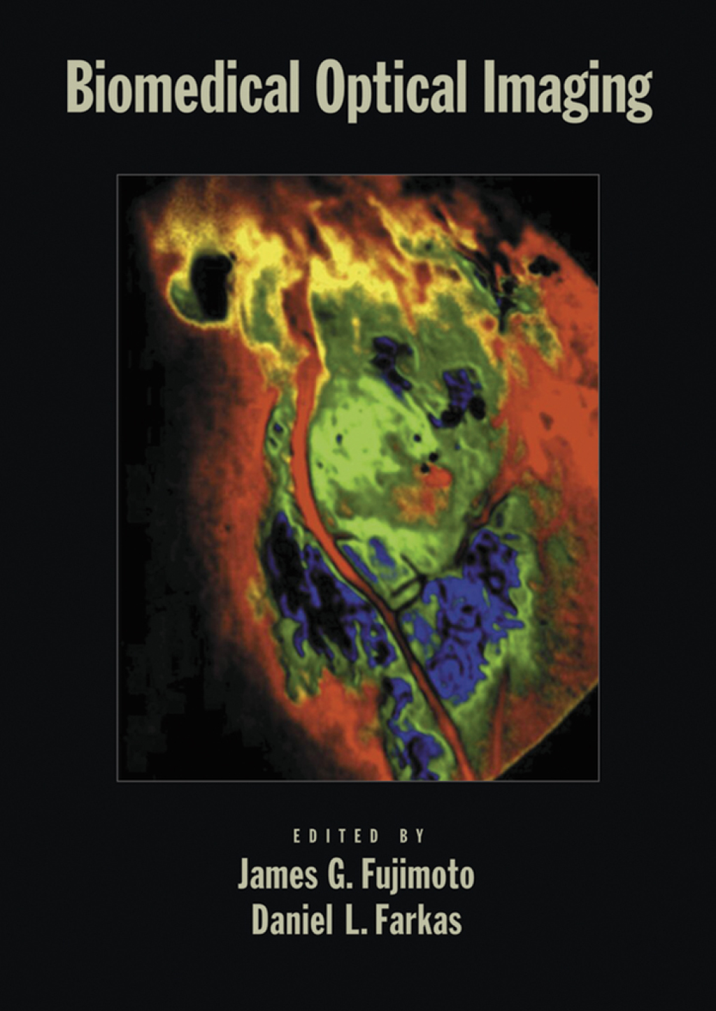 Biomedical Optical Imaging  â€“ PDF/EPUB Version Downloadable