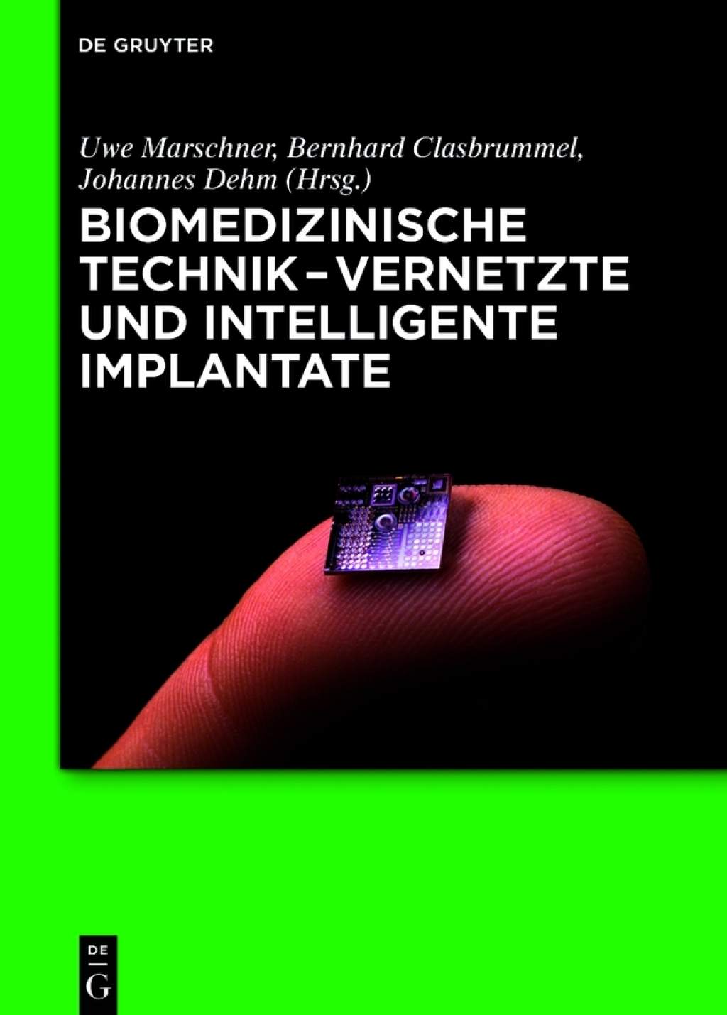 Biomedizinische Technik - Vernetzte und intelligente Implantate 1st Edition â€“ PDF/EPUB Version Downloadable