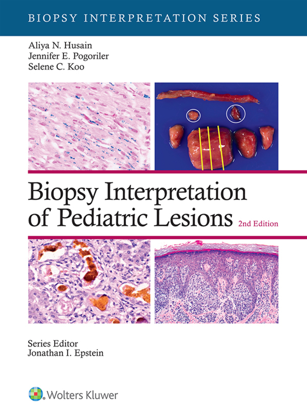 Biopsy Interpretation of Pediatric Lesions eBook with Multimedia 2nd Edition â€“ PDF/EPUB Version Downloadable