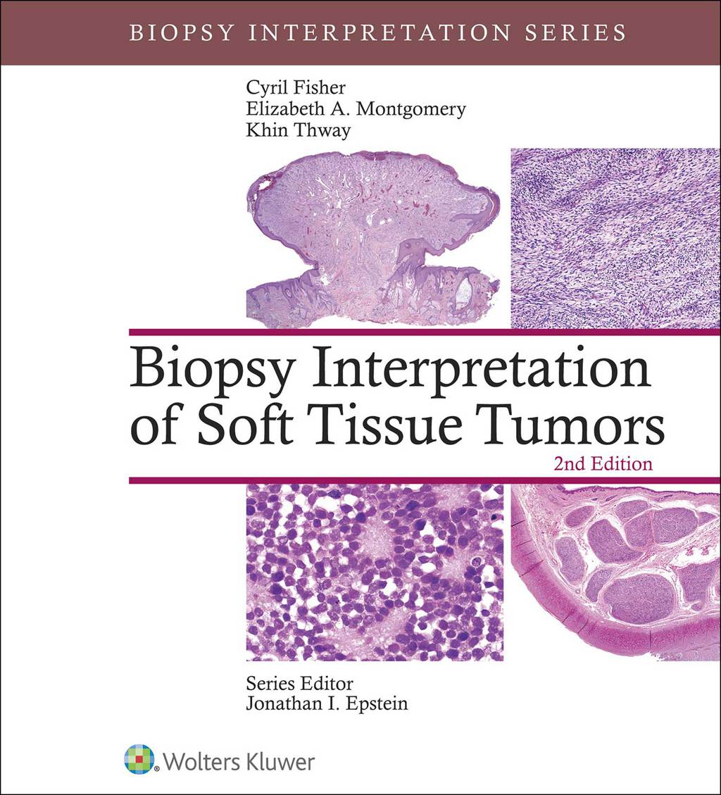 Biopsy Interpretation of Soft Tissue Tumors 2nd Edition â€“ PDF/EPUB Version Downloadable