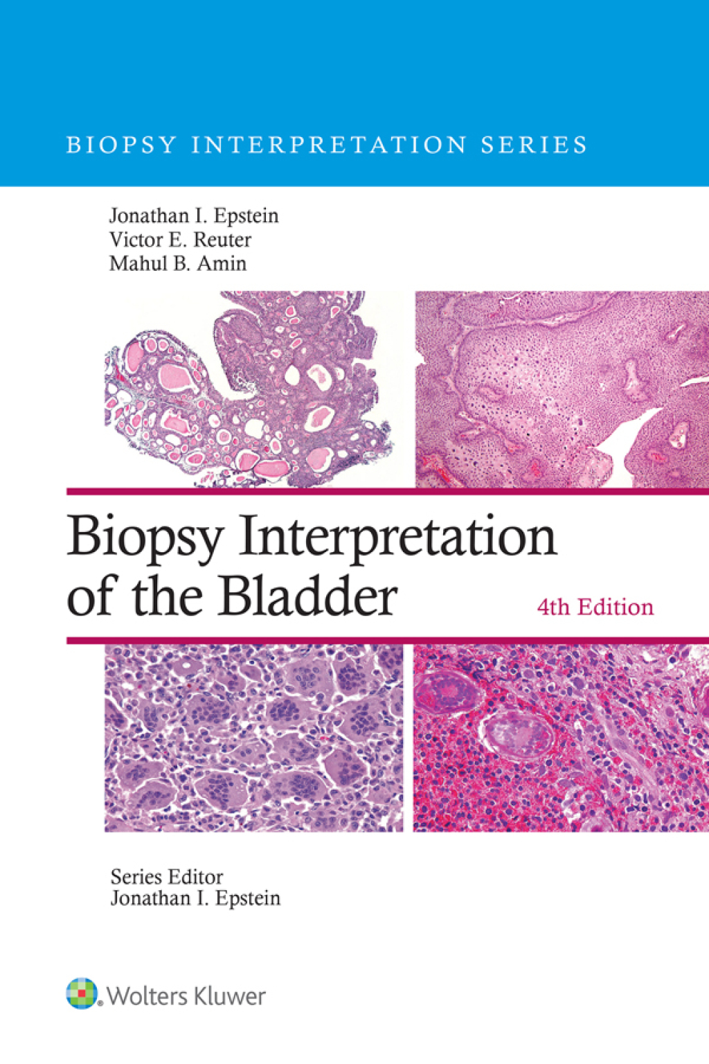 Biopsy Interpretation of the Bladder 4th Edition â€“ PDF/EPUB Version Downloadable