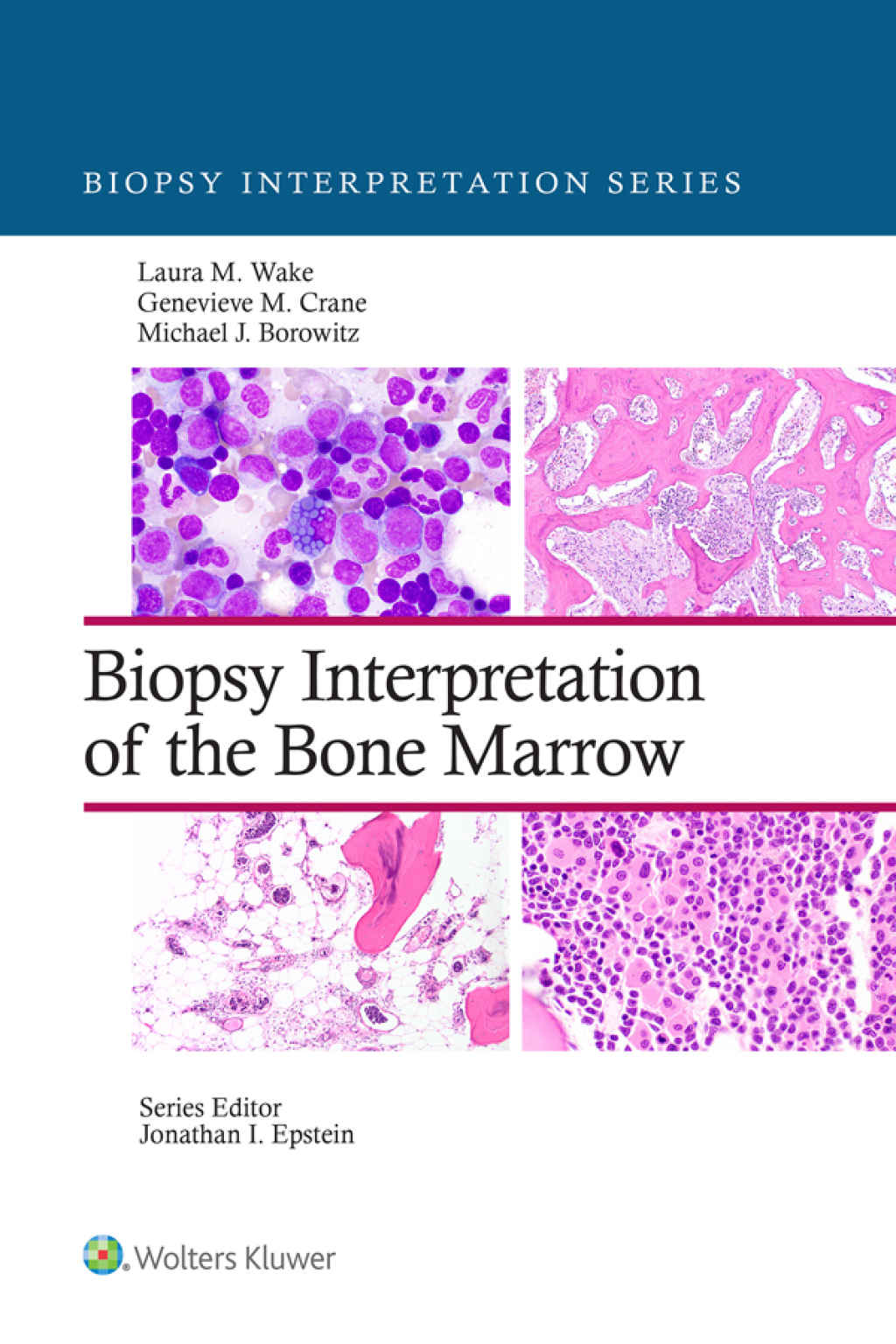 Biopsy Interpretation of the Bone Marrow 1st Edition â€“ PDF/EPUB Version Downloadable