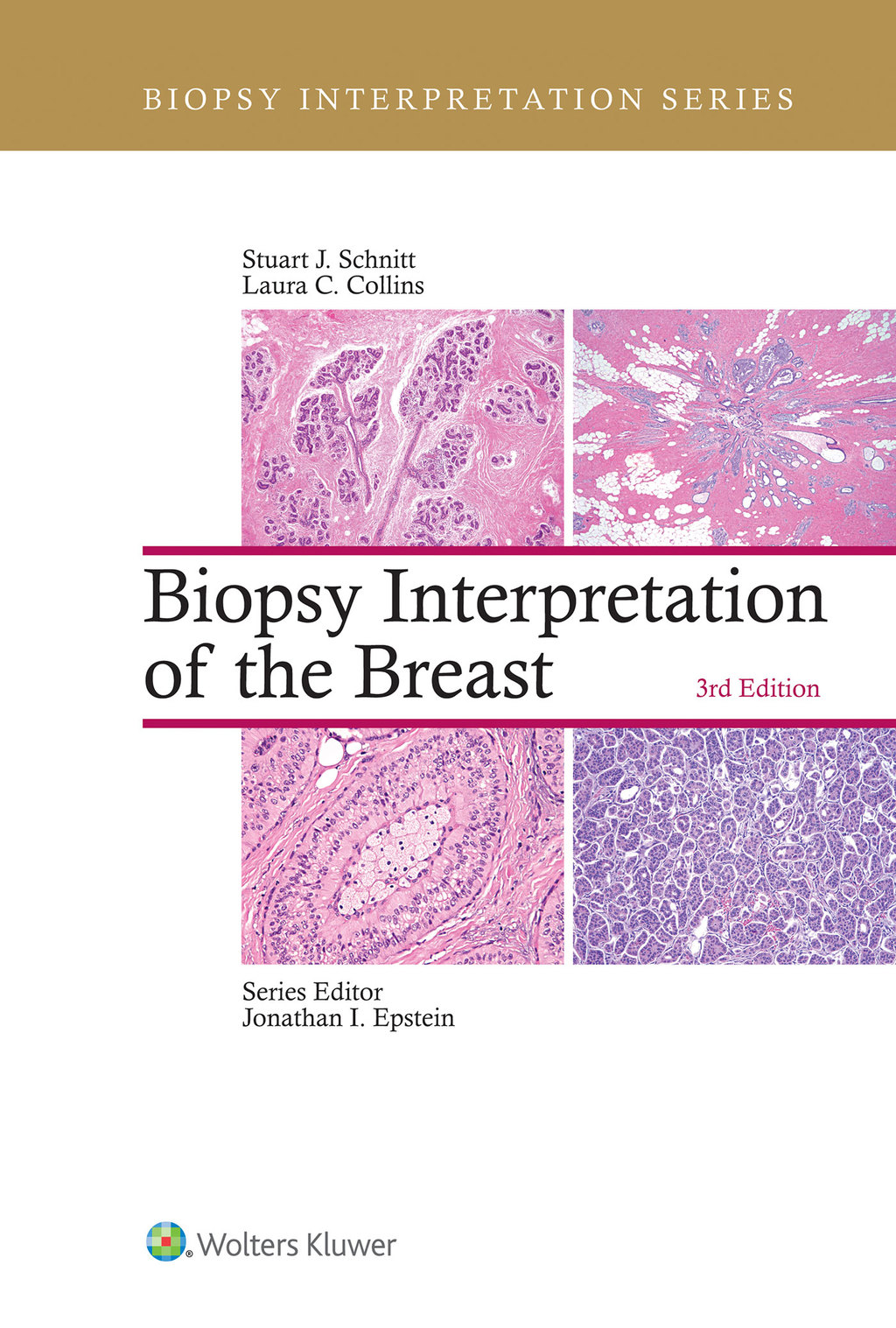 Biopsy Interpretation of the Breast 3rd Edition â€“ PDF/EPUB Version Downloadable