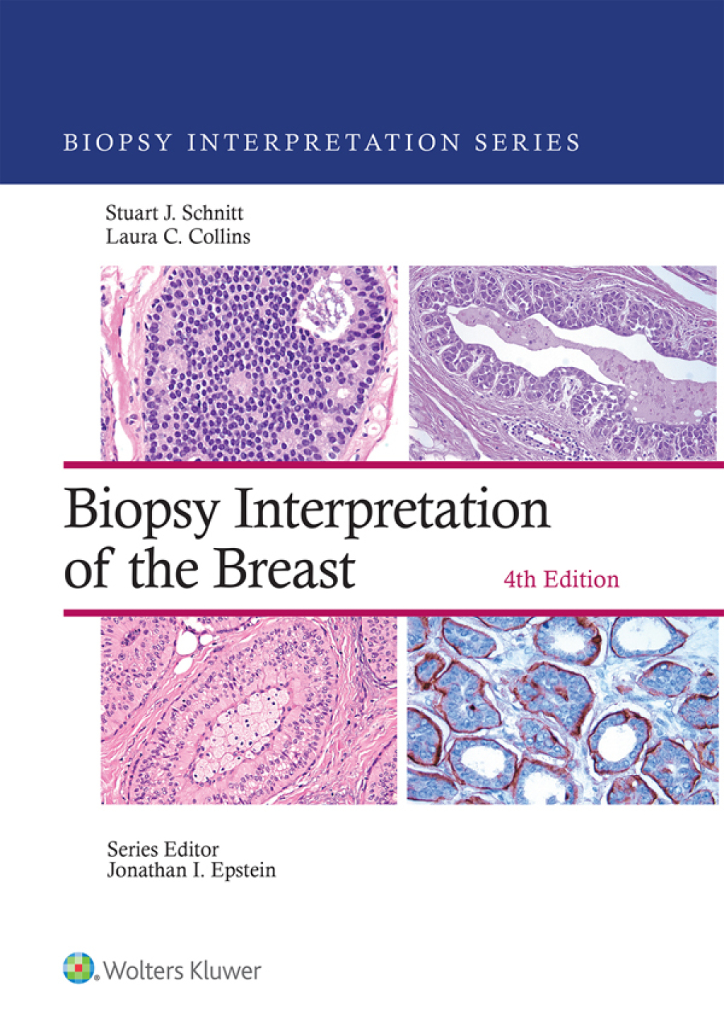 Biopsy Interpretation of the Breast eBook with Multimedia 4th Edition â€“ PDF/EPUB Version Downloadable