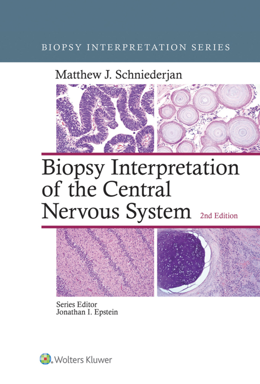 Biopsy Interpretation of the Central Nervous System 2nd Edition â€“ PDF/EPUB Version Downloadable