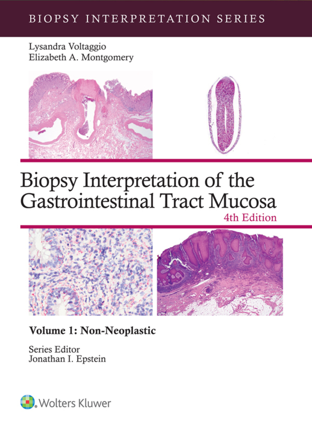 Biopsy Interpretation of the Gastrointestinal Tract Mucosa Volume 1 Non-Neoplastic: eBook with Multimedia 4th Edition â€“ PDF/EPUB Version Downloadable