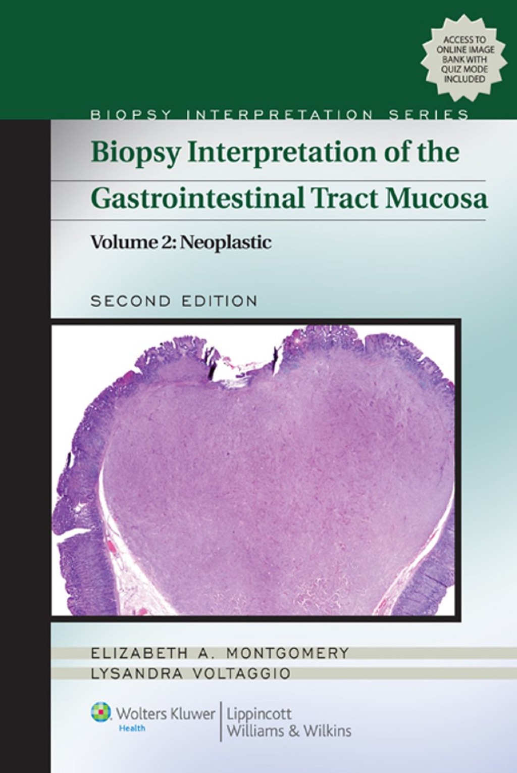 Biopsy Interpretation of the Gastrointestinal Tract Mucosa: Volume 2: Neoplastic 2nd Edition â€“ PDF/EPUB Version Downloadable