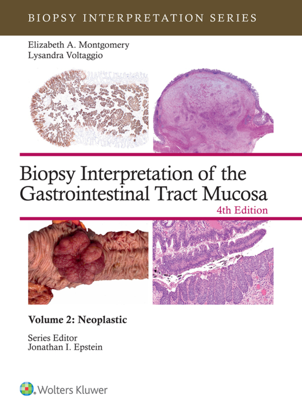 Biopsy Interpretation of the Gastrointestinal Tract Mucosa Volume 2 Neoplastic: eBook with Multimedia 4th Edition â€“ PDF/EPUB Version Downloadable