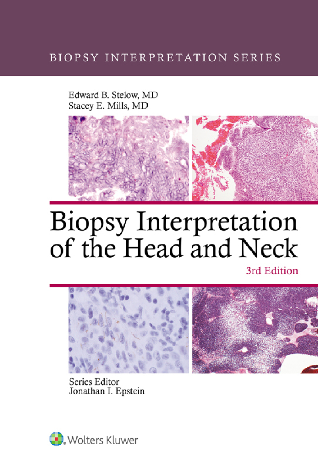 Biopsy Interpretation of the Head and Neck 3rd Edition â€“ PDF/EPUB Version Downloadable