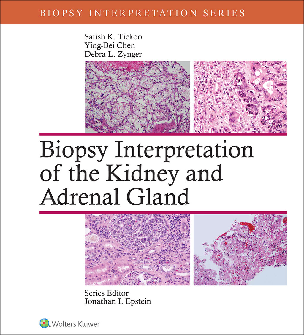 Biopsy Interpretation of the Kidney & Adrenal Gland â€“ PDF/EPUB Version Downloadable