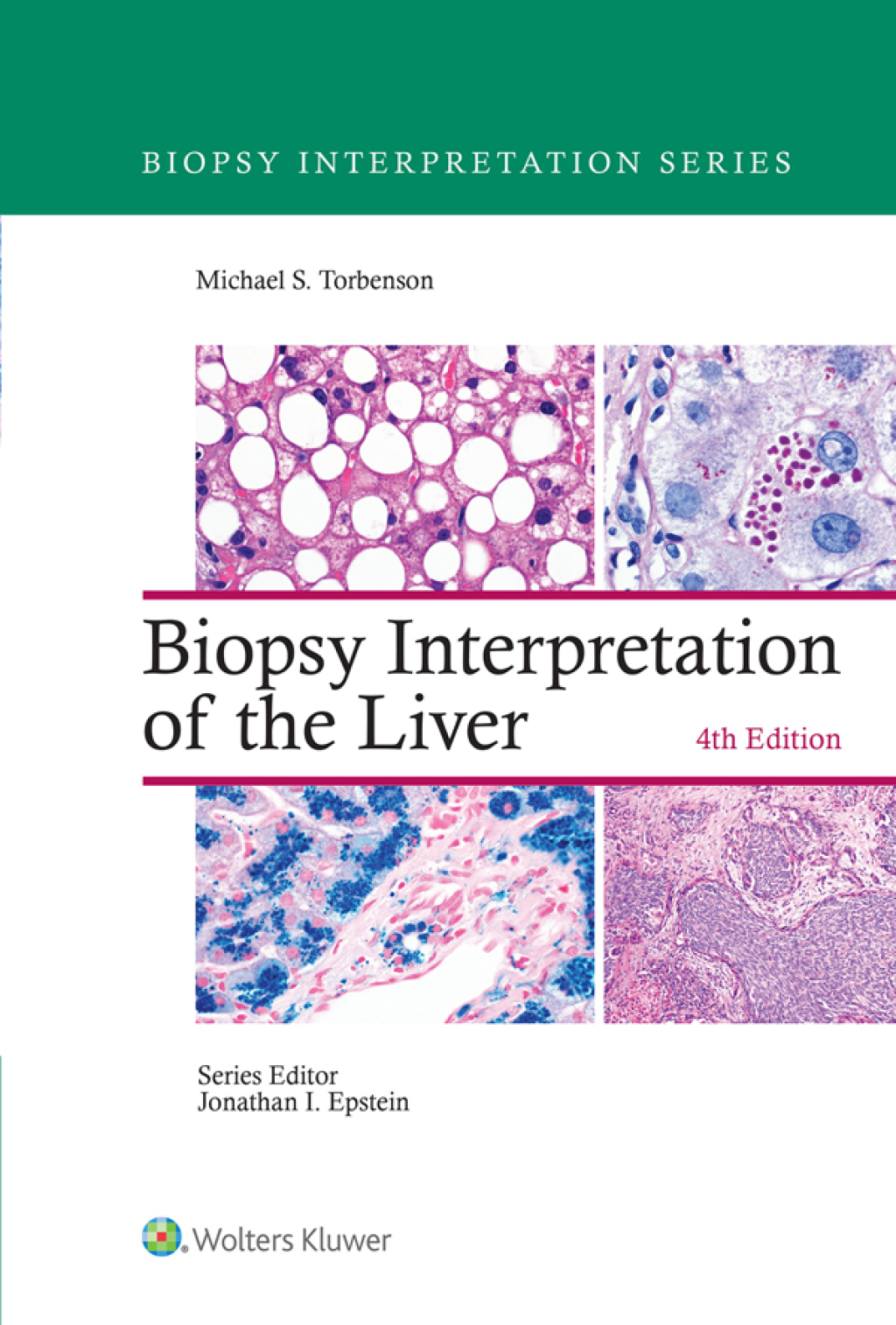 Biopsy Interpretation of the Liver 4th Edition â€“ PDF/EPUB Version Downloadable