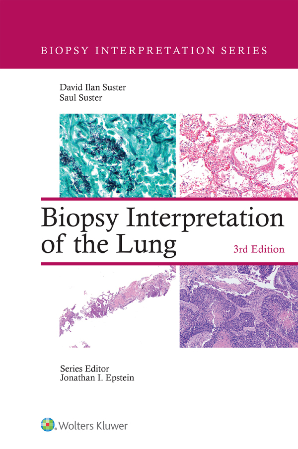 Biopsy Interpretation of the Lung eBook with Multimedia 3rd Edition â€“ PDF/EPUB Version Downloadable