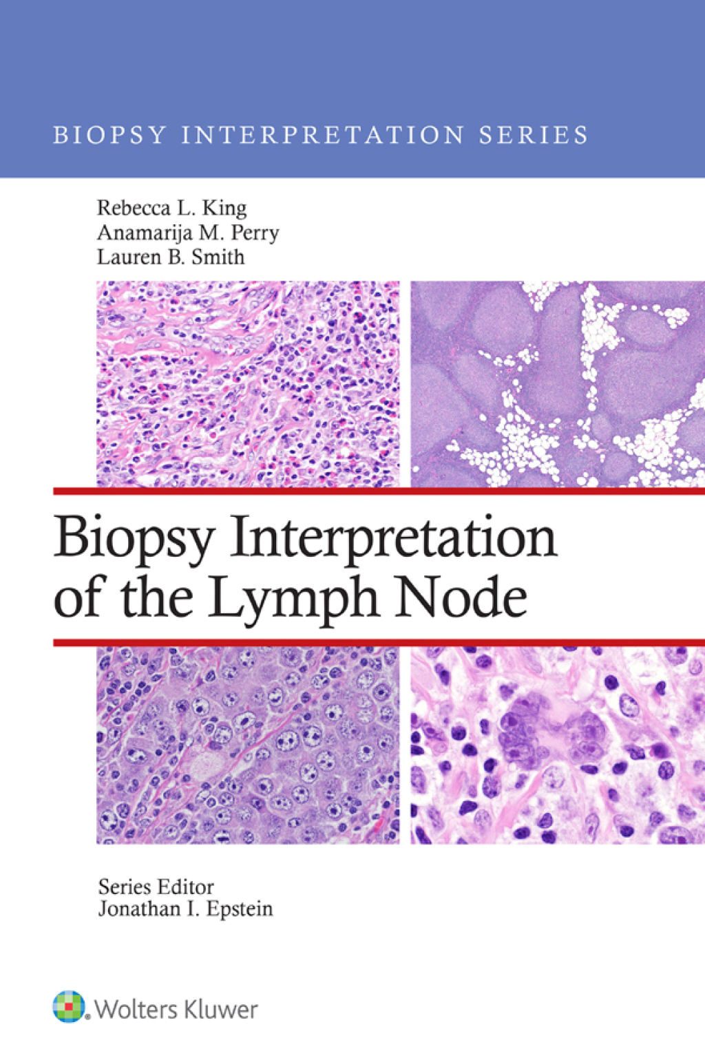 Biopsy Interpretation of the Lymph Nodes 1st Edition â€“ PDF/EPUB Version Downloadable