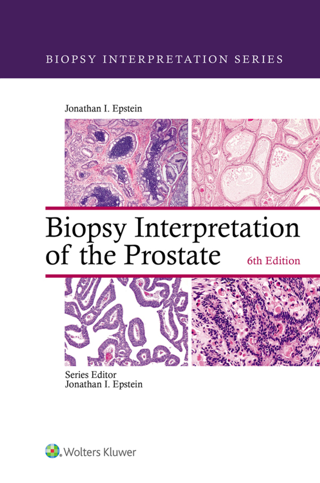 Biopsy Interpretation of the Prostate 6th Edition â€“ PDF/EPUB Version Downloadable