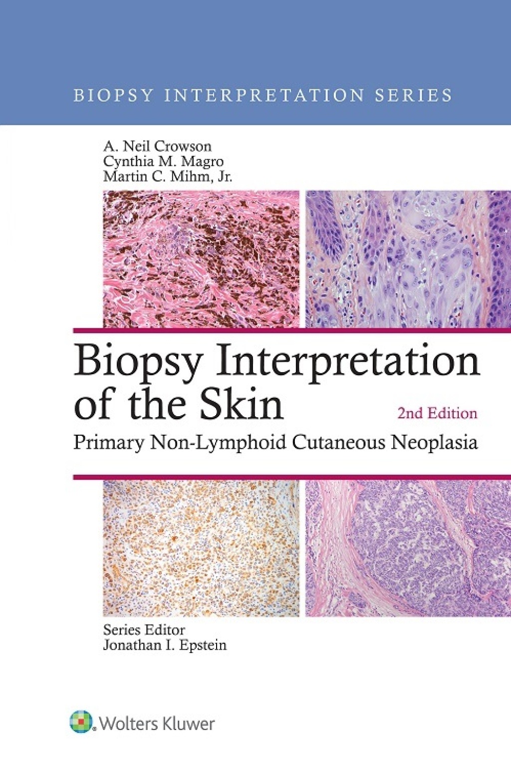 Biopsy Interpretation of the Skin Primary Non-Lymphoid Cutaneous Neoplasia 2nd Edition â€“ PDF/EPUB Version Downloadable